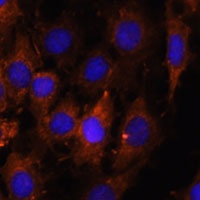 Anti-HEBP2 Antibody