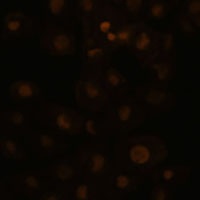 Anti-HEY1 Antibody