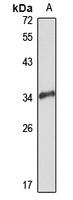 HRT3 Rabbit Polyclonal Antibody