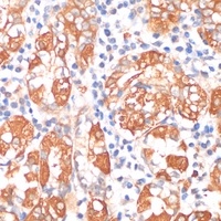 Anti-HHLA2 Antibody