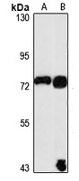 HIC-1 Rabbit Polyclonal Antibody