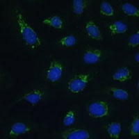Anti-HIGD1A Antibody