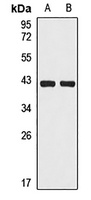 HLA-B Rabbit Polyclonal Antibody
