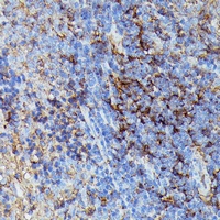 HLA-B Rabbit Polyclonal Antibody