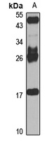 HLA-DMB Rabbit Polyclonal Antibody