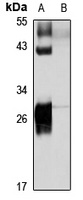HLA-DRB4 Rabbit Polyclonal Antibody