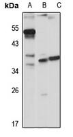 HLA-DRB5 Rabbit Polyclonal Antibody
