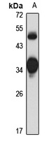 HLF Rabbit Polyclonal Antibody
