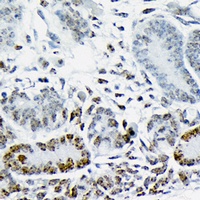 Anti-HMGA2 Antibody