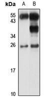 HMGB3 Antibody
