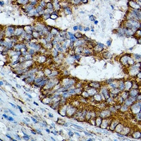 Anti-HMGCS2 Antibody