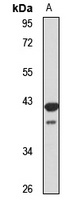 hnRNP A/B Antibody