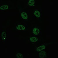 Anti-hnRNP A/B Antibody
