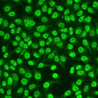 Anti-hnRNP D Antibody