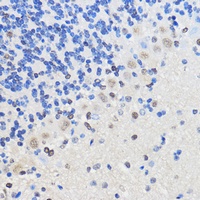 hnRNP U antibody