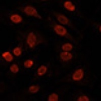 Anti-hnRNP U Antibody