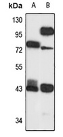 HOXA2 Rabbit Polyclonal Antibody