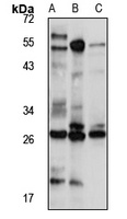 HOXB13 Antibody
