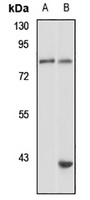 HPS-4 Rabbit Polyclonal Antibody