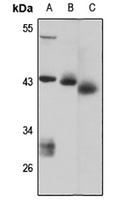 HS2ST1 Rabbit Polyclonal Antibody