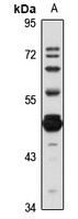 HS6ST1 Rabbit Polyclonal Antibody