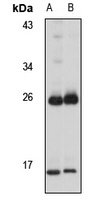 HSCB Rabbit Polyclonal Antibody