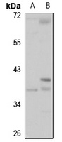 HSD17B1 Antibody