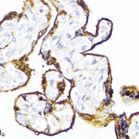 Anti-HSD17B1 Antibody
