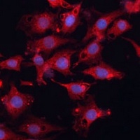 Anti-HSD17B1 Antibody