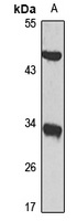 HSD17B3 Rabbit Polyclonal Antibody