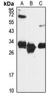 HSD17B8 Antibody