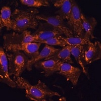 Anti-HSD17B8 Antibody