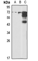 HSP70 Rabbit Polyclonal Antibody