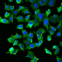 HSP70 Rabbit Polyclonal Antibody