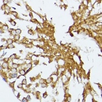 HSP70 Rabbit Polyclonal Antibody