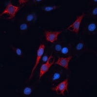 HSP70 Rabbit Polyclonal Antibody