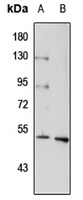 5-HT3B Rabbit Polyclonal Antibody