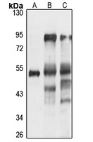 HTRA4 Rabbit Polyclonal Antibody