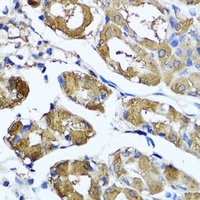 Anti-HYAL1 Antibody