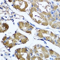 HYAL1 antibody