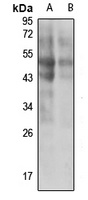 HYAL2 Rabbit Polyclonal Antibody