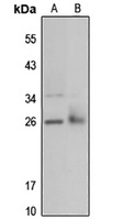 IDI1 Antibody