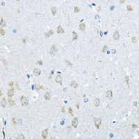 Anti-IDS Antibody