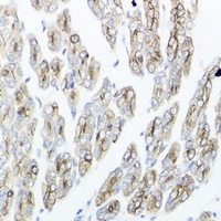 Anti-IEX1 Antibody