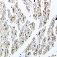 IEX1 antibody