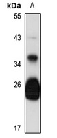 GILT Rabbit Polyclonal Antibody