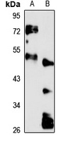 IFI-44L Rabbit Polyclonal Antibody