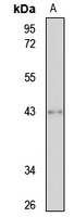 IFN-alpha 10 Rabbit Polyclonal Antibody