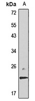 IFN-alpha 4 Rabbit Polyclonal Antibody