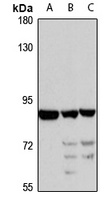 IFT81 Antibody